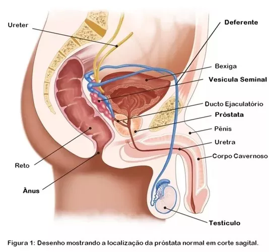 Hiperplasia-benigna-da-próstata