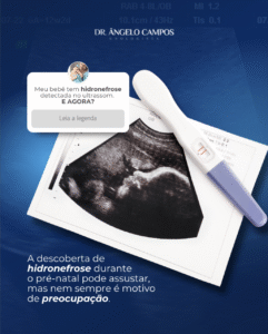 Meu bebê tem hidronefrose detectada no ultrassom, o que fazer?